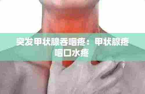 突发甲状腺吞咽疼:甲状腺疼咽口水疼