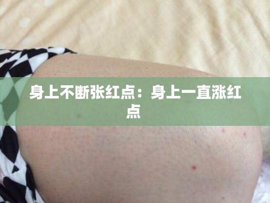 身上不断张红点:身上一直涨红点