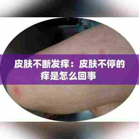 皮肤不断发痒：皮肤不停的痒是怎么回事 